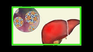 Alles über Hepatitis E