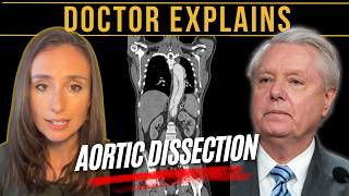 Lindsey Graham Update | Doctor Explains Aortic Dissection
