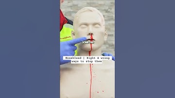 Nosebleed | Right & wrong ways to stop them