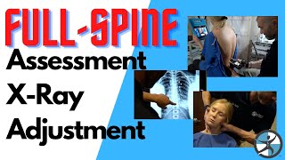 Marina's Full Patient Workup and Chiropractic Adjustment