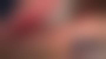 Physics Forceps Extraction of Upper Left Bicuspid w/ Crown from GoldenDent, Atraumatic Extraction