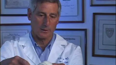 Articular Cartilage Paste Graft Technique: Interview with Dr. Kevin Stone