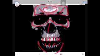 Mr Incredible Becoming Uncanny Phase 72