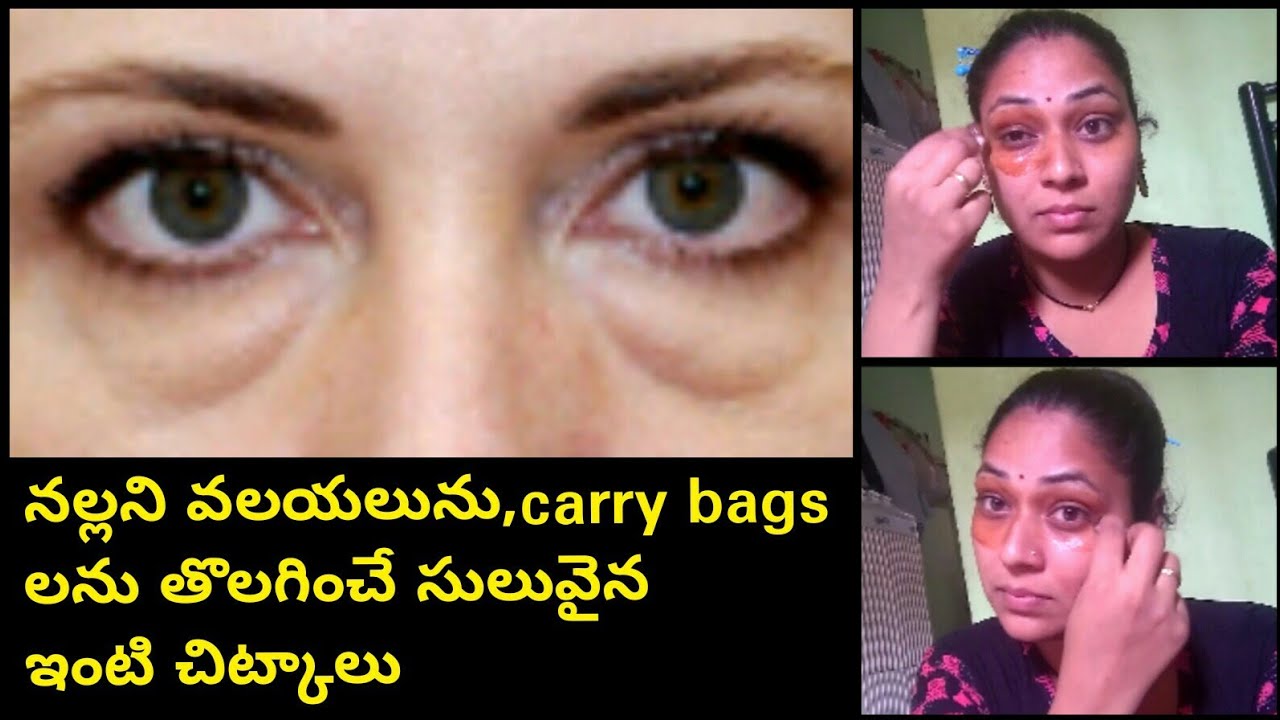 How to get rid of Eye Bags,dark circle naturally at home100