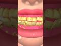 asmr teeth cleaning | #asmr #asmrcleaning #teethcleaning