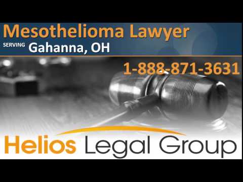 High-Quality Ohio Mesothelioma Lawyer Artwork Digital Art High-Quality Ohio Mesothelioma Lawyer Artwork Digital Art