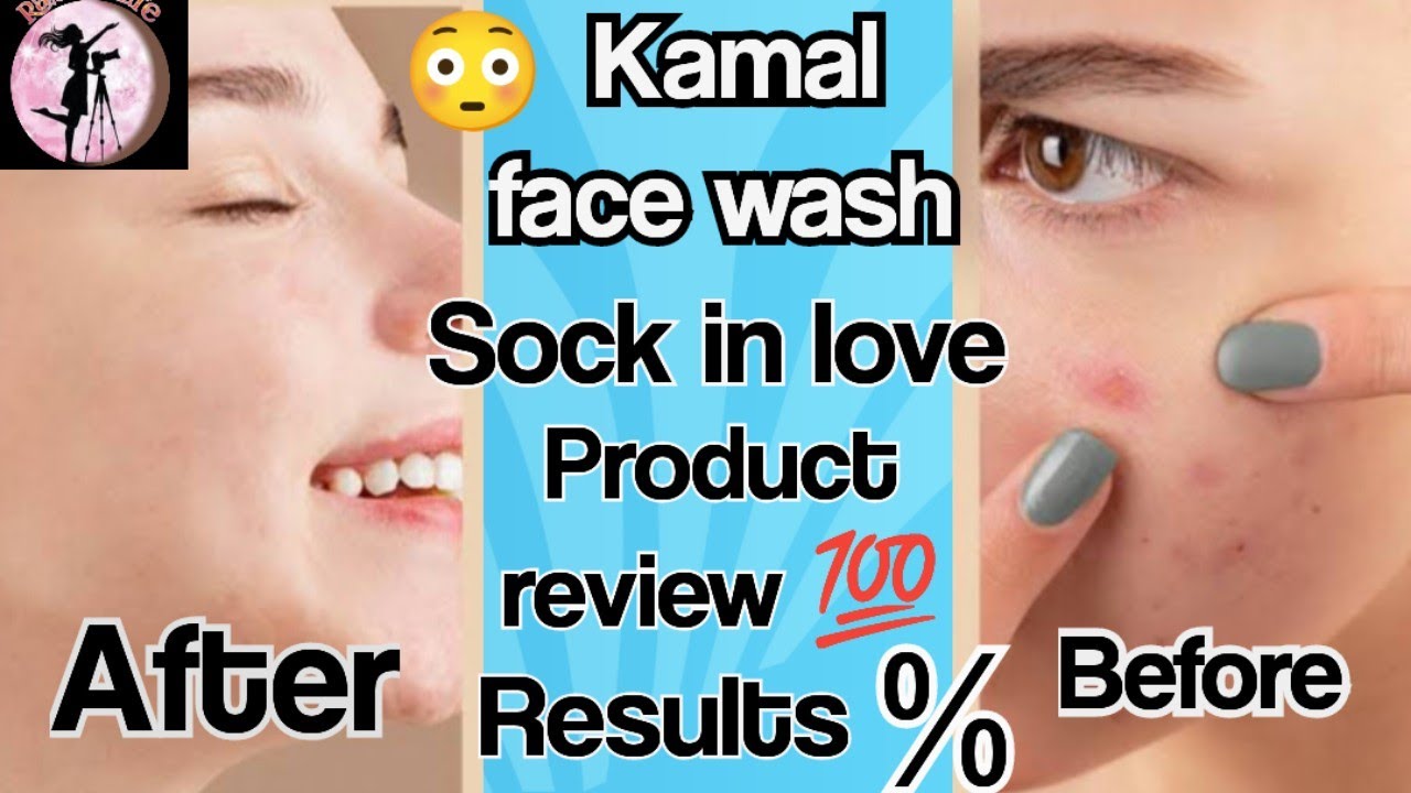 Best 💯 Best💯 😳 Face wash for oily acne prone skin ,Sock in love