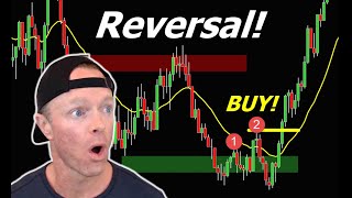 This *SLINGSHOT REVERSAL* Could Trigger a MASSIVE Squeeze!