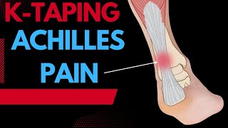 How to treat Achilles pain / tendonitis using Kinesiology taping techniques