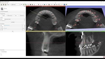 Curved multi-planar reconstruction (MPR) view in 3D Slicer