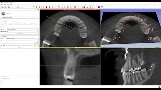 Curved multi-planar reconstruction (MPR) view in 3D Slicer