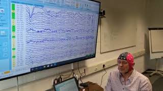 EEG Artefacts