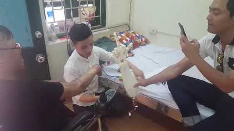 Làm chương trình trao cánh tay giả điều khiển bằng suy nghĩ cùng MC Phan Anh