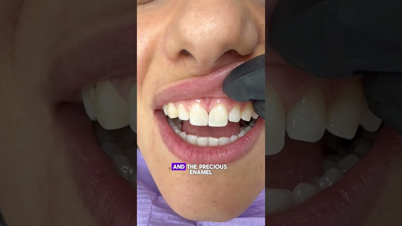 Minimally Invasive Cosmetic Dentistry | Smile Makeover in London | Optimal Dental Health
