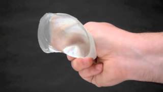 Gummy Bear Breast Implants Dr Barry Eppley Indianapolis.MOV