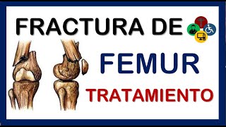 Fractura de FEMUR distal TRATAMIENTO de rehabilitación