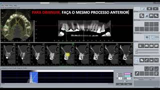 Visualizando e Manuseando Tomografias pelo OneVolumeViewer - MORITA