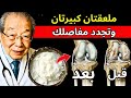 طبيب عظام يبلغ من العمر 97 عام ا يكشف هذا الطعام الطبيعي يجدد غضروف الركبة في 24 ساعة 