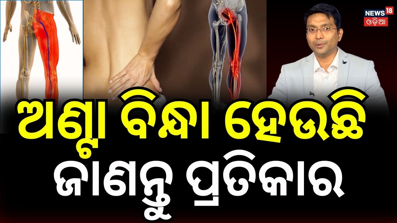 Effective Sciatica Pain Relief & Treatment | Exercises, Tips & Therapy | Odia News