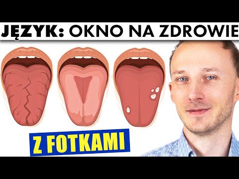 Wideo: 3 sposoby na przeprogramowanie mózgu