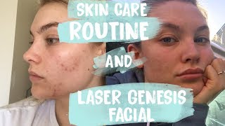 SKIN CARE ROUTINE | LASER GENESIS FACIAL
