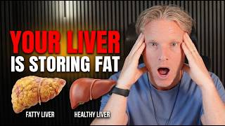 1 In 4 People Have Fatty Liver: Here’s How To Reverse It Naturally