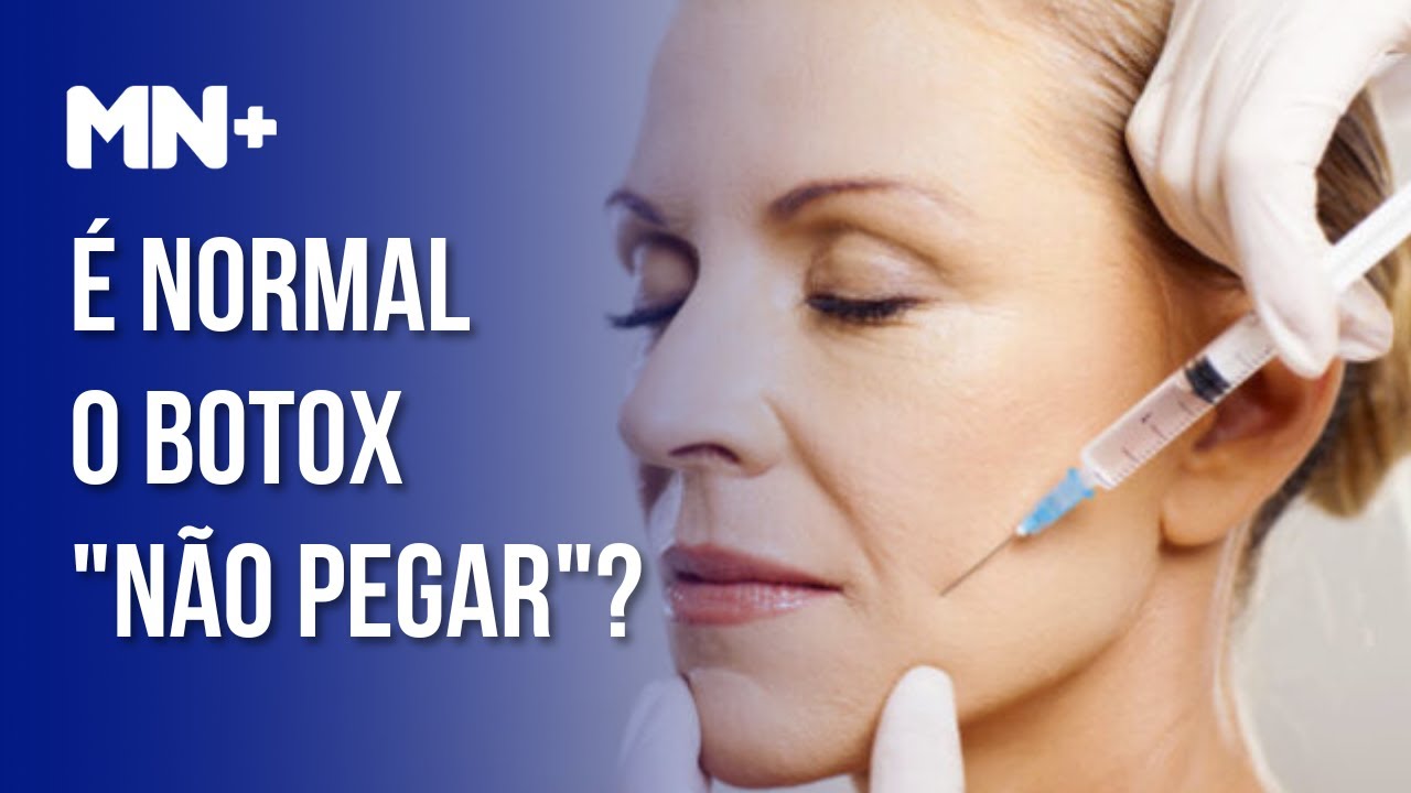 Meu botox não pegou. Isso é normal?