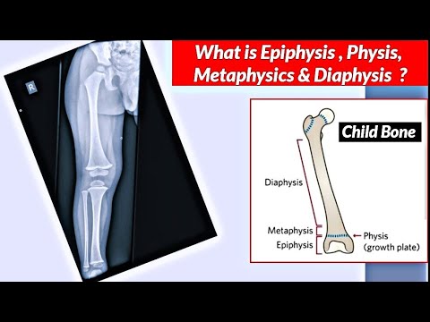 What is Epiphysis,Physis,Metaphysis & Diaphysis ? Children Long Bone ...