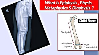 What is Epiphysis,Physis,Metaphysis & Diaphysis ? Children Long Bone Structure | Uday X Ray