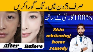 5 Day Whitening Challenge | Skin Whitening Home Remedy | Skincare Treatment | Best natural remedies