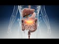 Ozempic and its side effects