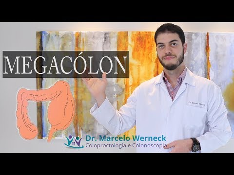 O que é Megacólon? Dr. Marcelo Werneck