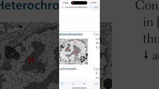 USMLE | First Aid 2023| Biochemistry | HeteroChromatin and Euchromatin #img #study #usmlestep #usmle