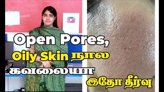 Oily open pores skin care 100 % Working Home Remedy | Skincare Tips to Clean & Minimize Large Pores