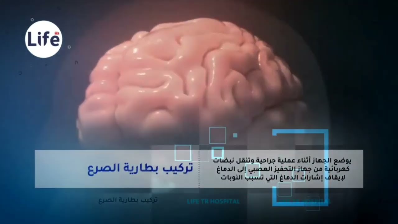 مركز جراحة المخ والاعصاب في مشفى لايف تركيا