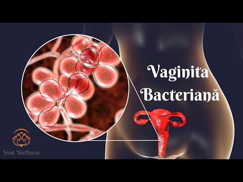 Video: Poate enterobacterii aerogeni să fermenteze lactoza?