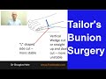 Tailors Bunion Surgery | Seattle Podiatrist