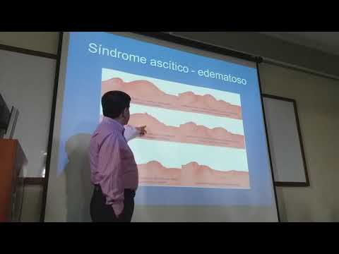 Sd ascítico edematoso