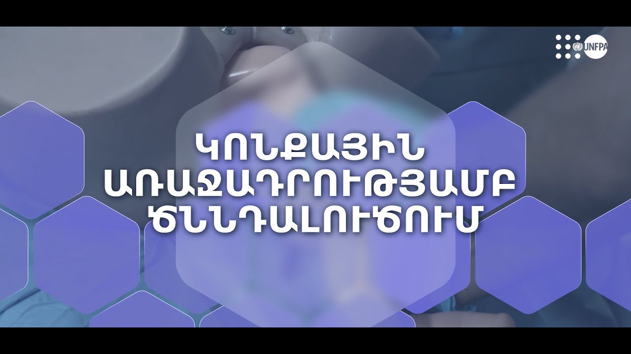 Կոնքային առաջադրությամբ ծննդալուծում