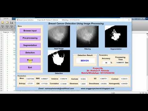 Breast Cancer Detection Using Machine Learning Matlab Source Code | Breast Cancer Classification