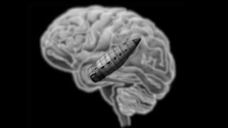 PURC 74 Welcom into the brain