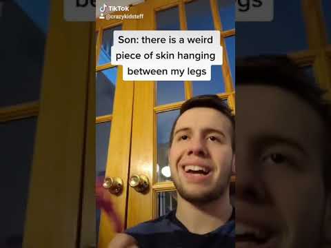 Tiktok Kid Cutting His Weiner Off