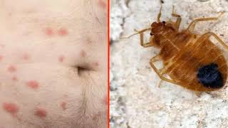 Best Pest Control in Jackson Michigan, Pest Control