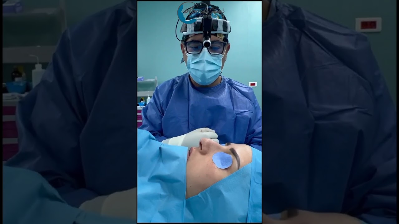 Rhinoplastie ultrasonique au bloc avant et après 