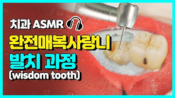 사랑니 뽑는 과정 완벽 공개 | 고품격 치과 ASMR | 당신이 아~한 사이에