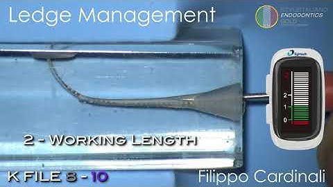 Cardinali - ledge management