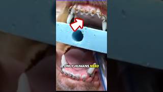 Download Lagu Could your dog actually need braces?! MP3