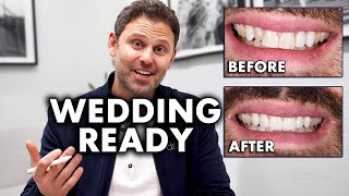 How Porcelain Veneers Can Change Your Life - Dental Science