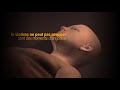 Vidéo: Dispositif anti-étouffement enfant et adulte LifeVac