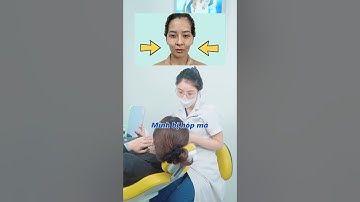 Niềng răng có bị hóp má không?| Lạc Việt Intech Niềng Răng #shorts